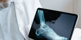 Care sunt cauzele osteoporozei